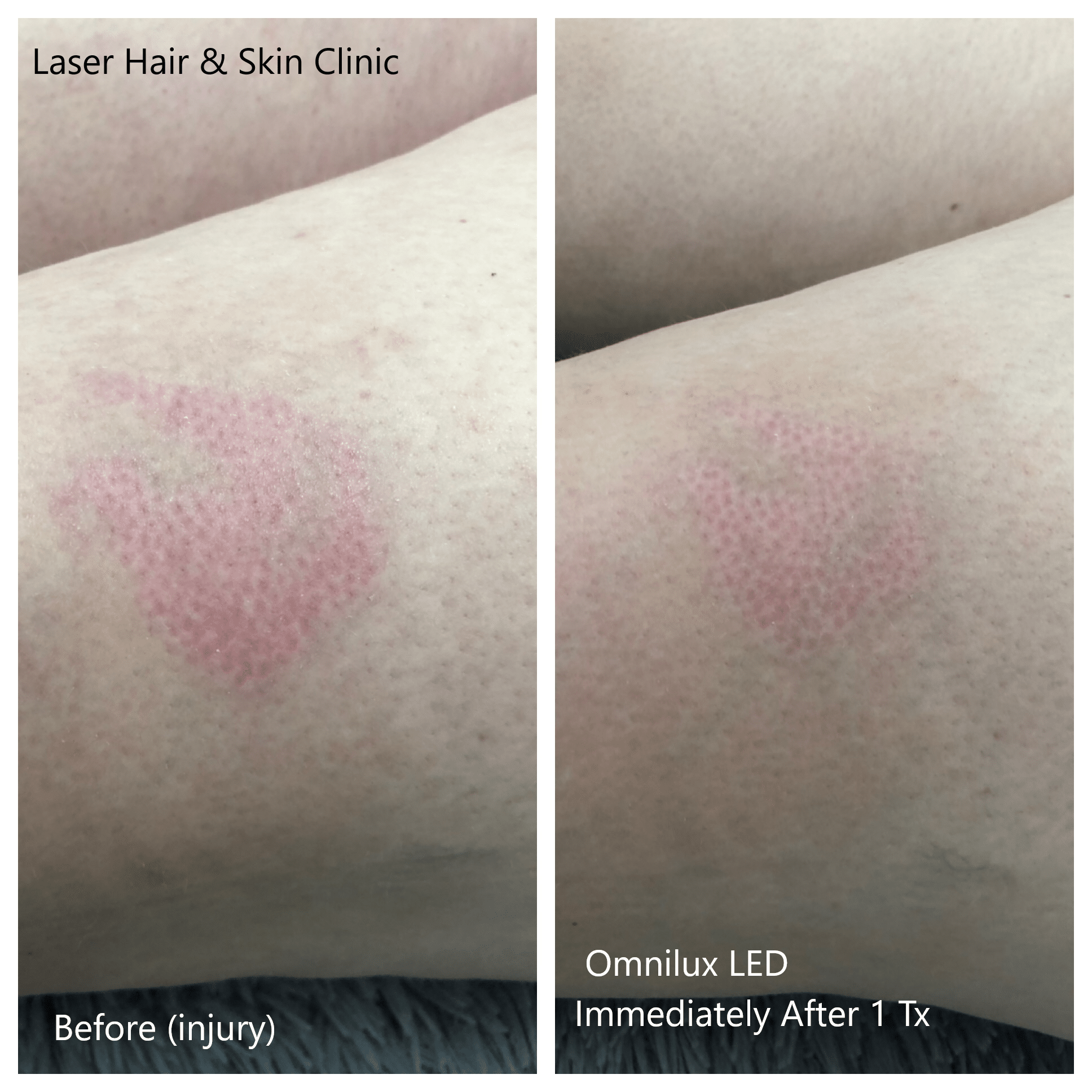 Rejuvenation Dr Rosane Muniz