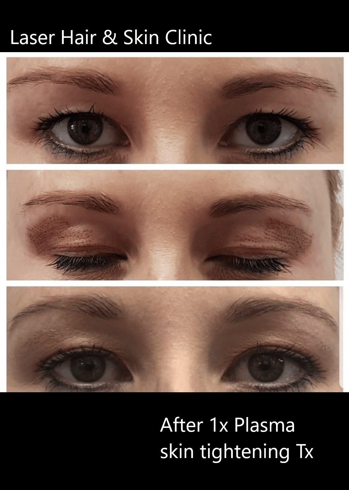 Rejuvenation Dr Rosane Muniz