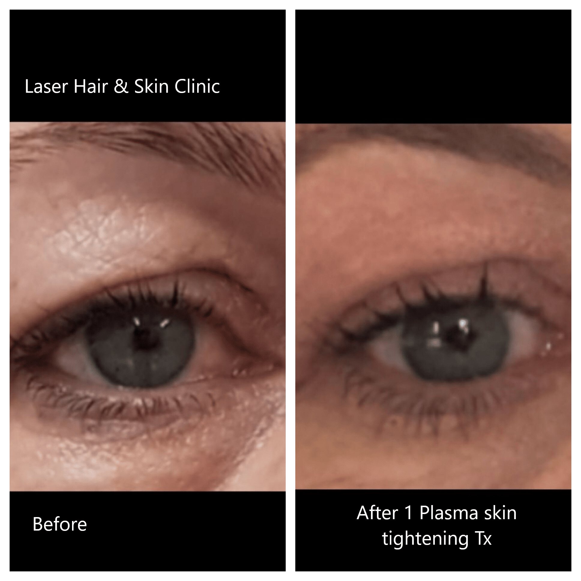 Rejuvenation Dr Rosane Muniz